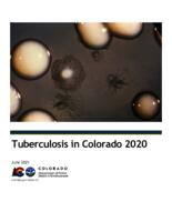 Tuberculosis in Colorado. 2020